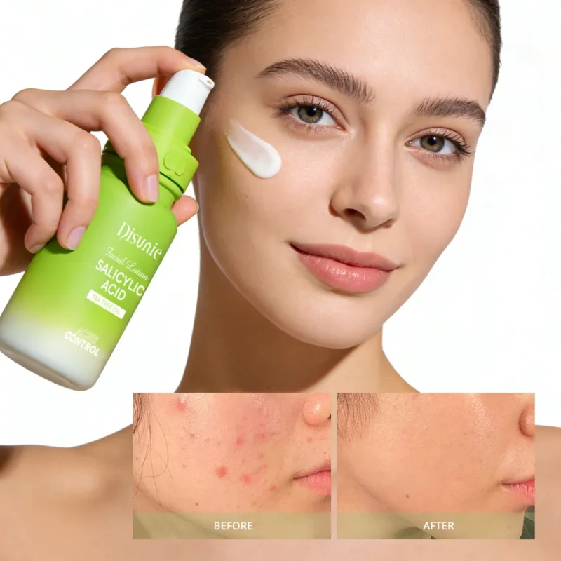 Disunie Salicylic Acid & Tea Tree Oil Facial Lotion Supplier | Bulk Wholesale