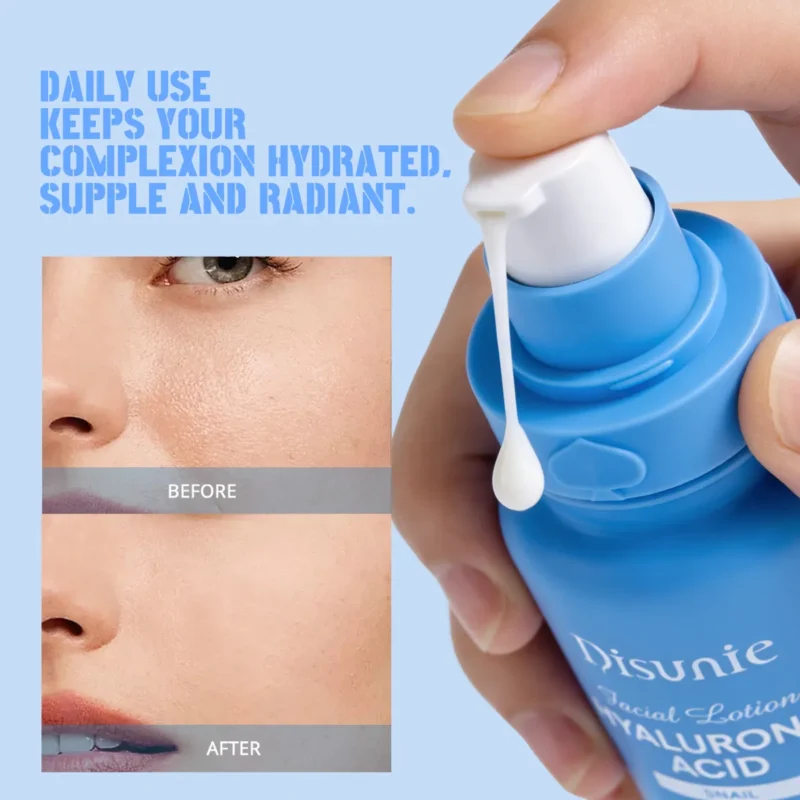 Disunie Hyaluronic Acid & Snail Facial Lotion Supplier | Bulk Wholesale