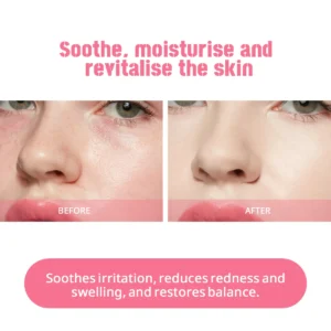 Disunie Rose & Hyaluronic Acid Facial Lotion Distributor | Wholesale Partnership