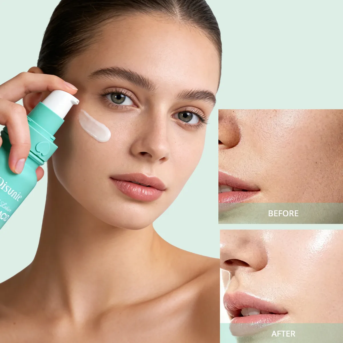 Disunie Kojic Acid & Niacinamide Facial Lotion Supplier | Bulk Wholesale