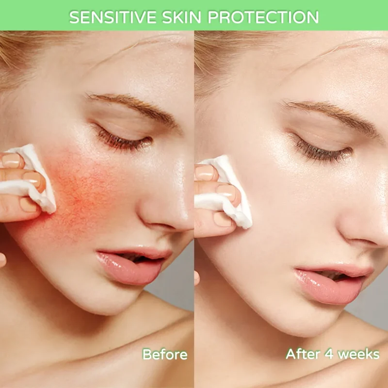 Disunie Kojic Acid & Pomegranate Serum Distributor | Wholesale